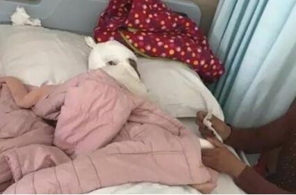 煤炉加热八宝粥突然爆炸 济宁一岁男婴脸被炸伤!