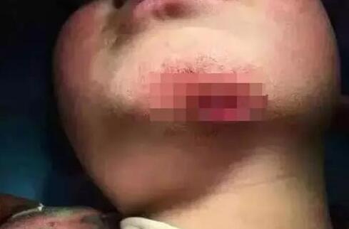 临沂7岁男孩遭母亲虐待？警方：尚不构成虐待罪