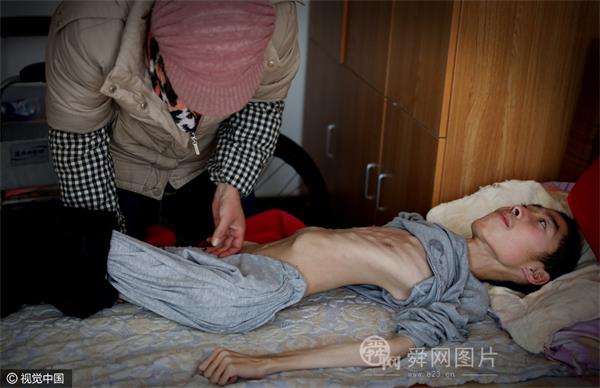威海母亲照顾“肌无力”儿子11年 为让儿子吃胖垃圾箱捡食物