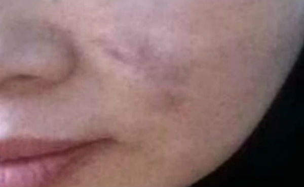 东营女子美容险变毁容 调查：学军医疗美容诊所无资质