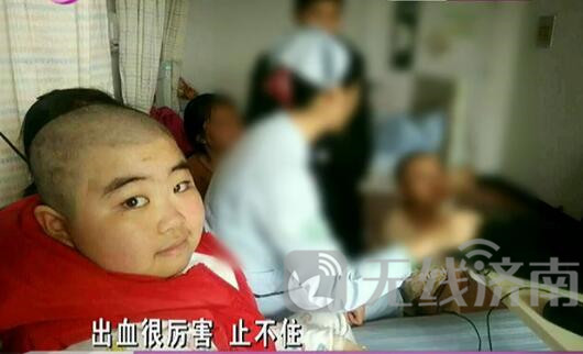 救救她!济南一10岁女孩患病生命垂危急需A型血小板