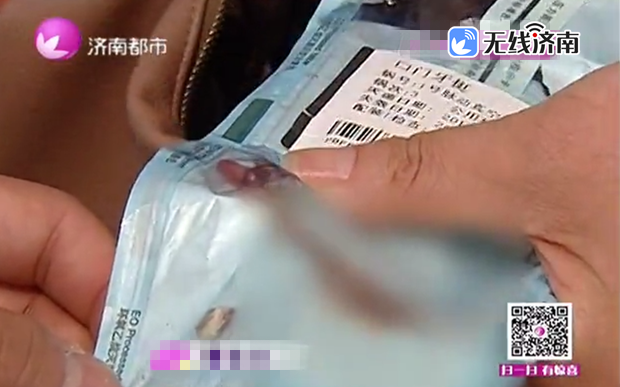 济南女子吃饭牙齿被石子硌两半 酒店：没保存石子只担一半责任