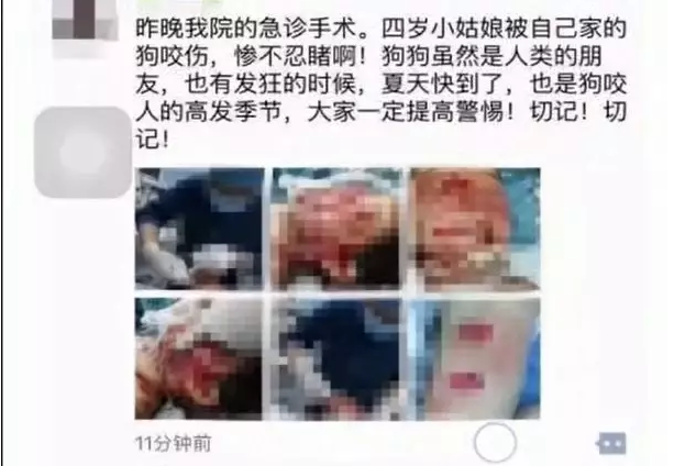 潍坊寿光4岁女童被自家狗咬伤 整个头被咬烂血肉模糊