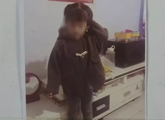 潍坊寿光4岁女童被自家狗咬伤 整个头被咬烂血肉模糊