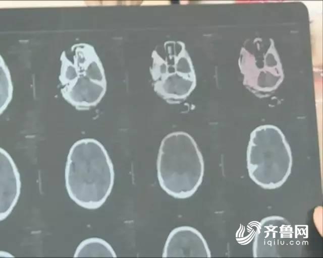 济宁祖孙俩拾荒为生 孩子父亲自称太忙四年没露面