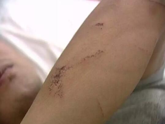 代驾有风险！济南一代驾小哥被醉酒车主用板砖一顿暴打