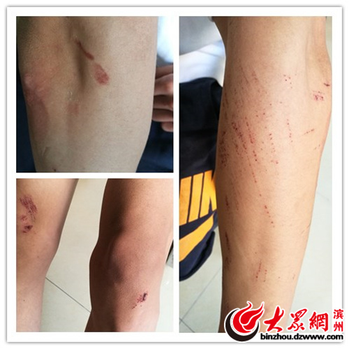 滨州学院大学生情侣校园内搂抱被查 起争执遭围殴