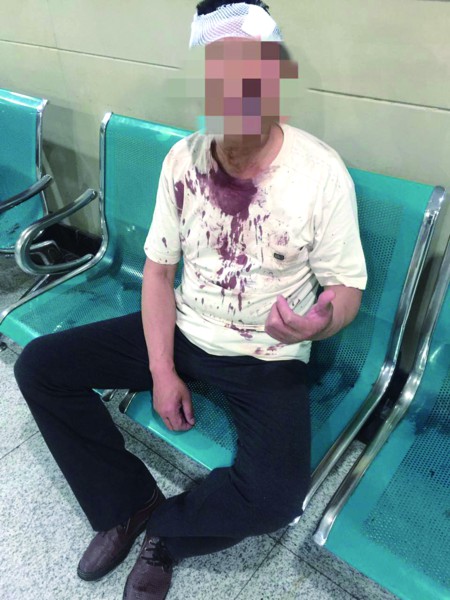 让路起纠纷5旬男子被打伤 警方正在和家属一起寻找打人者