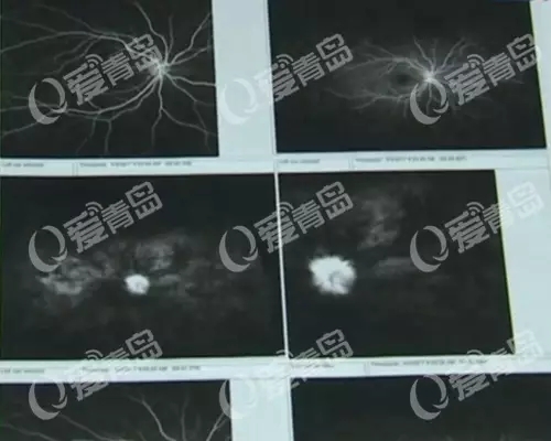 25���ൺ�����겣������ʧ���Գ�Ѫ ع�����λ�����ȥ¥��