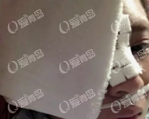 25���ൺ�����겣������ʧ���Գ�Ѫ ع�����λ�����ȥ¥��