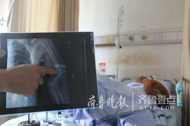 济南西营镇村民救火路上遇车祸 高额费用压垮5个家庭