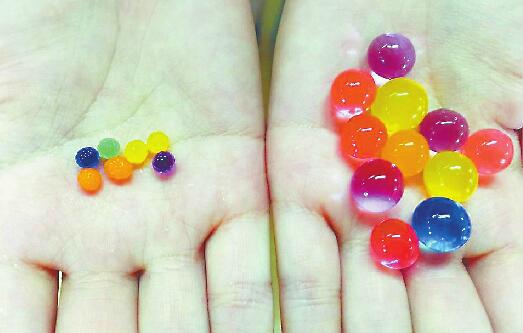 济南男童肠梗阻取出十几颗“水精灵” 实为吸水树脂