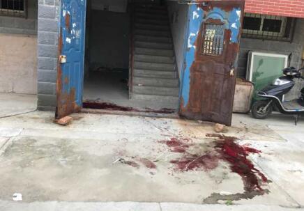 济南六旬老太遭老伴割喉 行凶者疑患有抑郁症