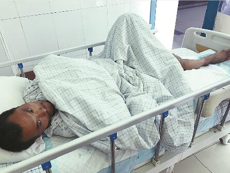 流浪汉半夜把摩拜投河被刮落河岸摔断腿 苦撑3小时获救