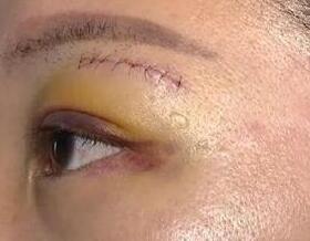 Ů�Ӿ���������Ѫ��������9�� �Ƶ괲��װ��ľ����Կ���(ͼ)