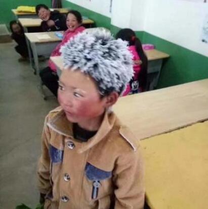 ���������к��ж����� �����к�ð��ѩ��ѧͷ����üë��������