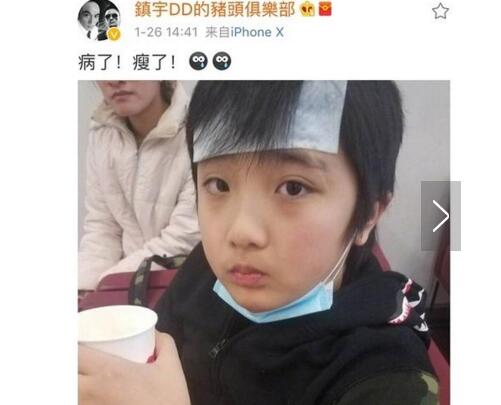 心疼！吴镇宇晒费曼近照疤痕明显 爸爸去哪2费曼眼角受伤所致