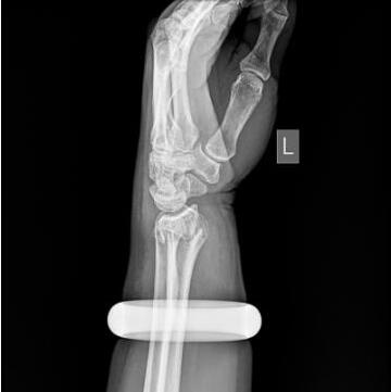 贫限想!砸2万玉镯保手臂 57岁大妈“割爱”贴身饰物原因大曝光