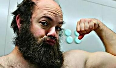 30岁猛男高大毛发又浓密,花百万美金整容,变20岁少女充满自信