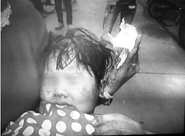 天降砖头把2岁女童砸成重伤！法院判18个住户一起赔