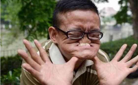 骨骼清奇！男子以丑获吉尼斯 你能用嘴咬住自己的鼻子吗？