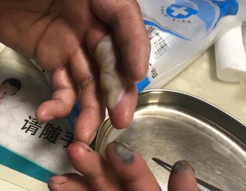 ��Ŀ����!�㽭һ���������ֱ����ظ�ʴ �ж��������������⴦��