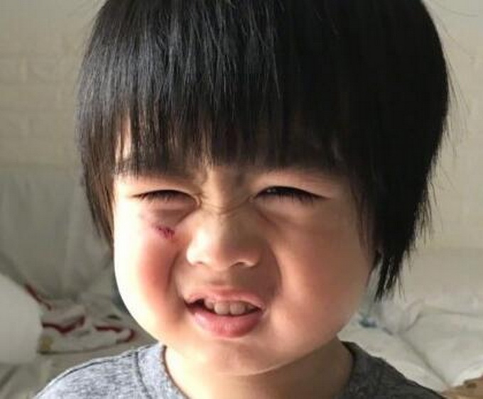 �ۣ���־ӱ���ӵ�������Ӱ����ֵ ����:���װ�û��ˤ�˻��ܺ���