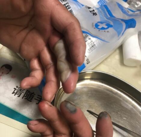 ��Ŀ����!������˫�ֱ���ʴ �ж��������Ϧҹ�����˰���(ͼ)