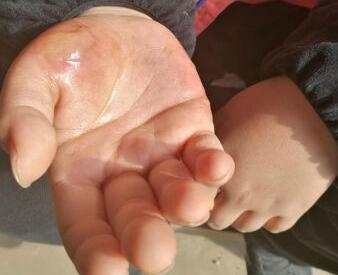 ����!�к�ֻ������ɽ�� 11���������ֱ��ദ�����̲�ס����(ͼ)