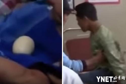 震惊！男孩产20个鸡蛋吓傻医生 切开里面或全是蛋黄或全是蛋白