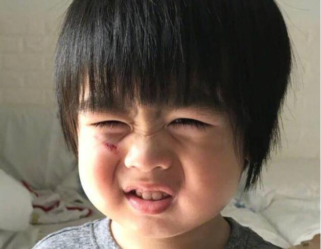 Kyson����!��־ӱ���ӵ����� �۾��·�Ѫ�����Դ���������������