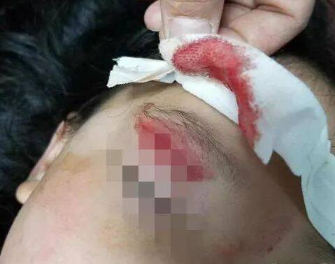 ɽկ�ǻ�!�����Ʊ���ٸ���� 5��Ů��������α��ҵ�ͷ��Ѫ�ȹǶ���