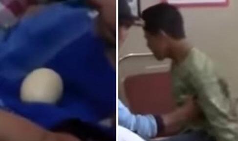 活久见!男孩产20个鸡蛋 14岁印尼小伙古怪“行为”惊呆医生(图)