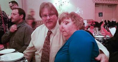 怪胎？女子靠一个孔呼吸 失去右眼和鼻子通过眼窝上方的孔呼吸 