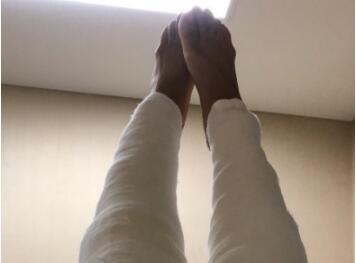 触目惊心!徐梦桃晒术后伤口惨不忍睹 因韧带断裂被切除70%半月板