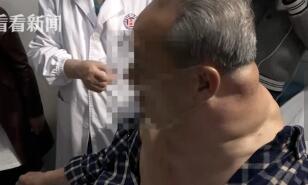 大爷喝酒成绿巨人 每天几乎一秒都离不开救脖子粗的是别人的几倍