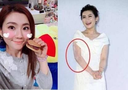 P图无良!Selina怒斥商家 拿别人痛处去做虚假宣传无耻商家太缺德了