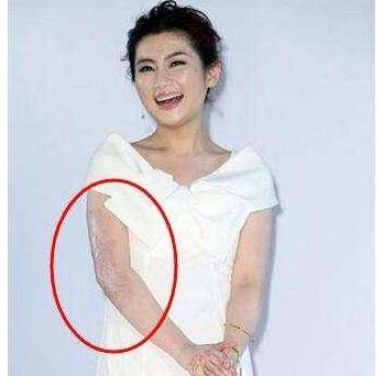 Selina晒照片打脸无良商家，铜锣烧变祛疤膏，拿伤疤做宣传太无耻