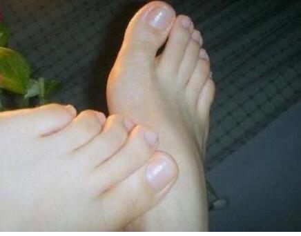 女子15年没有洗脚,被受采访上台脱掉鞋子后,所有人顿时痴呆了