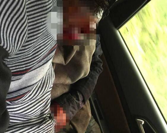 令人震惊！村民寻药遭黑熊袭 被熊拍一巴掌