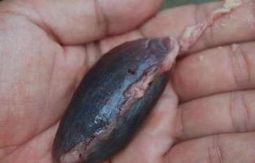 坑娃偏方！给幼童喂食活蝌蚪 一只大白瓷碗里游着七八条给孩子“下火”