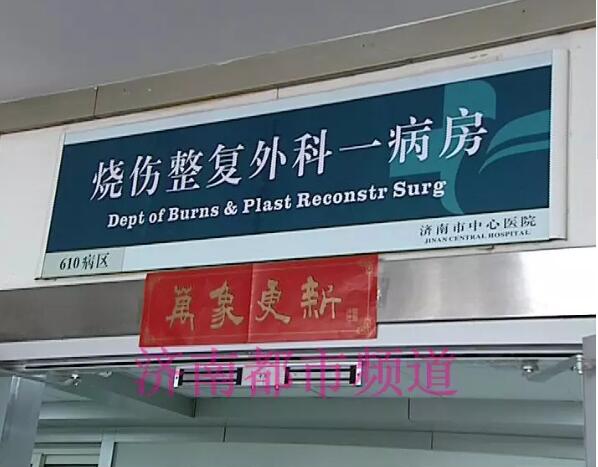 飞来横祸!济阳一女子洗澡时致特重度烧伤住进ICU 