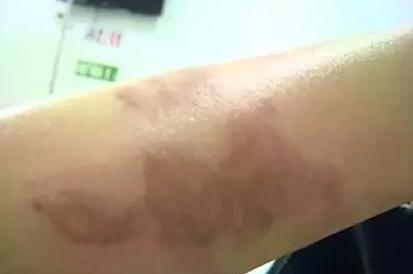 元凶亮了!双皮奶爆炸致女主毁容