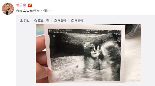 生完再补婚礼!曹云金宝宝B超照 妻子唐菀预产期就在这个月
