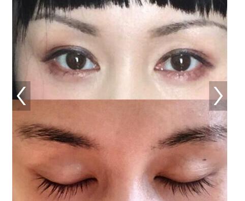 睫毛精!王子文眉毛回来了 之前为了拍戏变成了