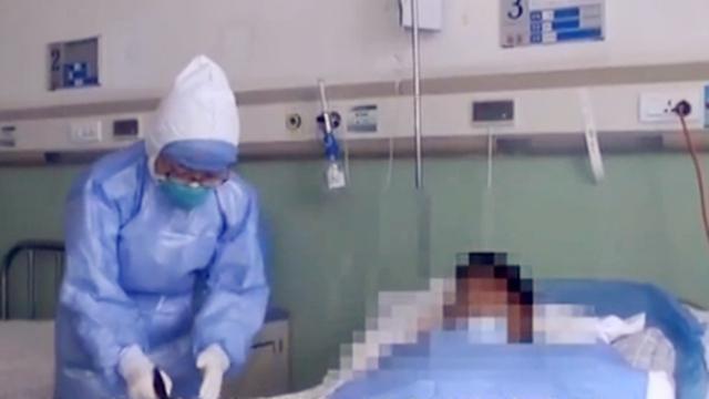 宁夏海原报告3例皮肤炭疽病例 专家：虽危险但可控可治