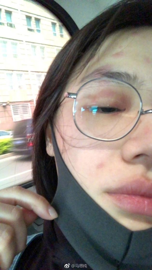 ̫���ˣ���˼����״������Ƭ̫���� ��״�����׳�