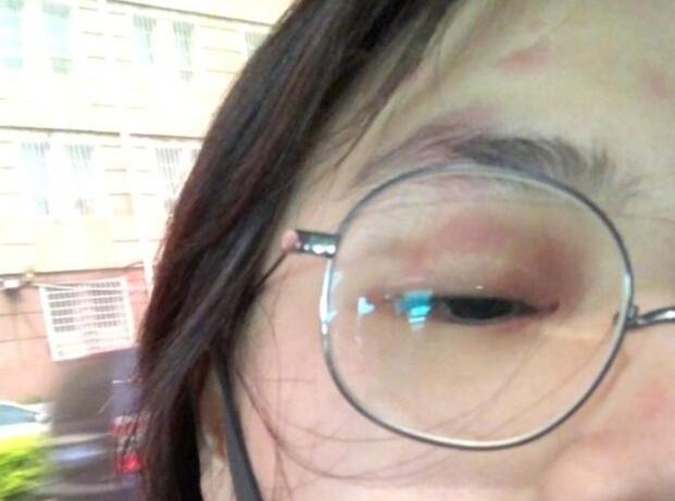 ̫���ˣ���˼����״������Ƭ̫���� ��״�����׳�