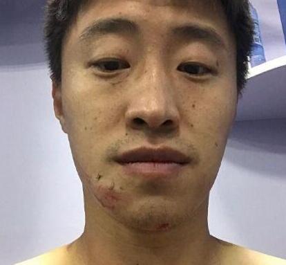 踩人外援禁赛10场 郝强配文怒斥：不知道在国外你也敢这样吗?