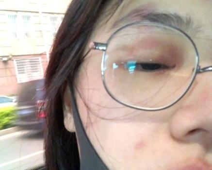 ����?��˼����״����̫���� ͷ�ۡ��������ܰ����Դ�����ֹ���